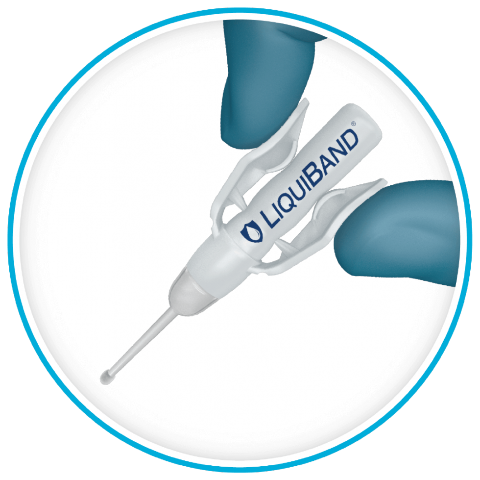 LiquiBand® Optima Topical Skin Adhesive Wound Closure