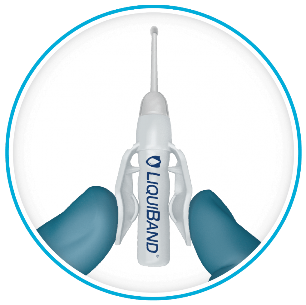LiquiBand® Optima Topical Skin Adhesive Wound Closure