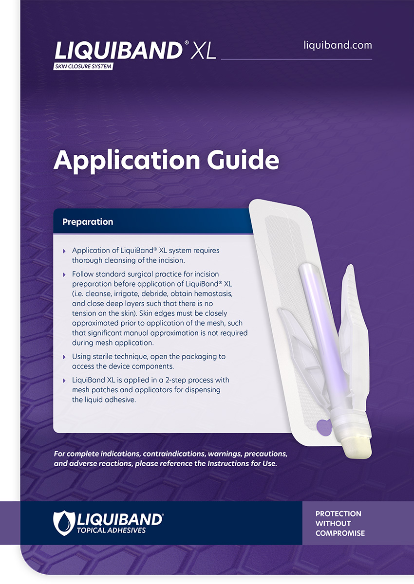 LiquiBand® XL<br /> Application Guide 